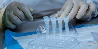 Coronavirus Uruguay: 2.657 casos nuevos y 51 fallecidos este s�bado