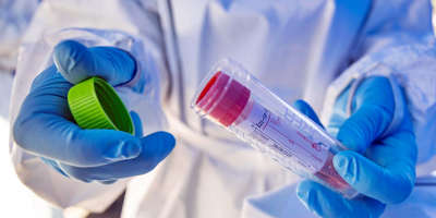 Con la suma de 40 fallecimientos por la covid-19 se superaron los 3.100 en el pa�s