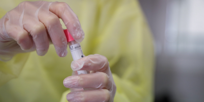 Covid-19: Hay un total de 36.757 personas con la enfermedad en el pa�s