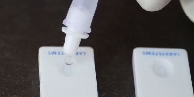 Estado m�s poblado de Brasil identifica 19 variantes de covid en circulaci�n