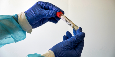 Se registraron 142 casos nuevos y cinco muertos por Covid-19