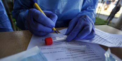 Se registraron 123 casos nuevos de covid-19 y cinco fallecidos este martes