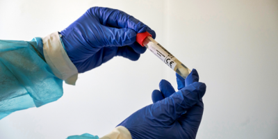 MSP afirma que hay "baja circulaci�n" de la variante delta del coronavirus