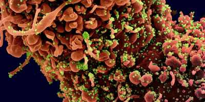 Respuesta inmune al SARS-CoV-2 es distinta a la de otros virus, seg�n estudio