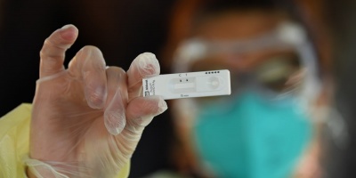 Coronavirus Uruguay: 163 casos nuevos y un fallecido