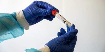 Coronavirus: se registraron 181 casos nuevos de la covid-19 y un fallecido