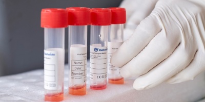 Coronavirus: OMS advierte que nueva variante es de riesgo y posiblemente ms contagiosa