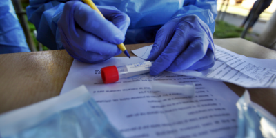 141 casos nuevos de coronavirus, no se registraron fallecimientos