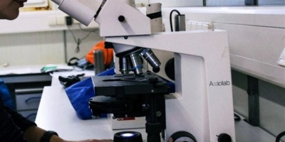 Otros 20 casos de hepatitis en nios en el Reino Unido