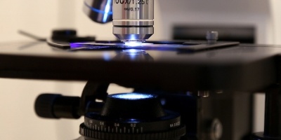  Preocupa el aumento de infecciones bacterianas que causan Faringitis o Escarlatina