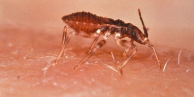 La OMS advierte que el Chagas "sigue siendo un problema de salud p�blica", especialmente en Latinoam�rica