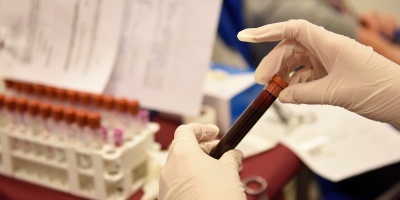 La Asociaci�n de Hemofilia de Uruguay busca extender nuevo tratamiento a mayores de 18 a�os 