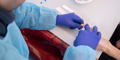 La ministra de Salud P�blica anunci� que ser� obligatorio el test de PCR para confirmar los casos de hepatitis C