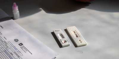 Este lunes se realizar� una jornada de test de VIH en la explanada de la Intendencia de Montevideo