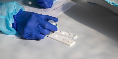 Se realiza este lunes una jornada de test gratuitos de VIH en la explanada de la Intendencia de Montevideo