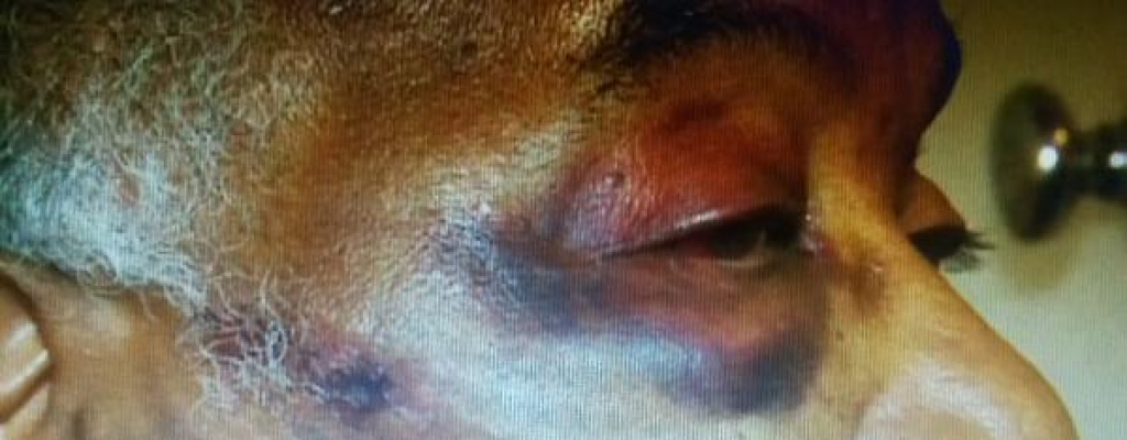 Taxista agredido ampli� la denuncia porque sufri� una amenaza telef�nica