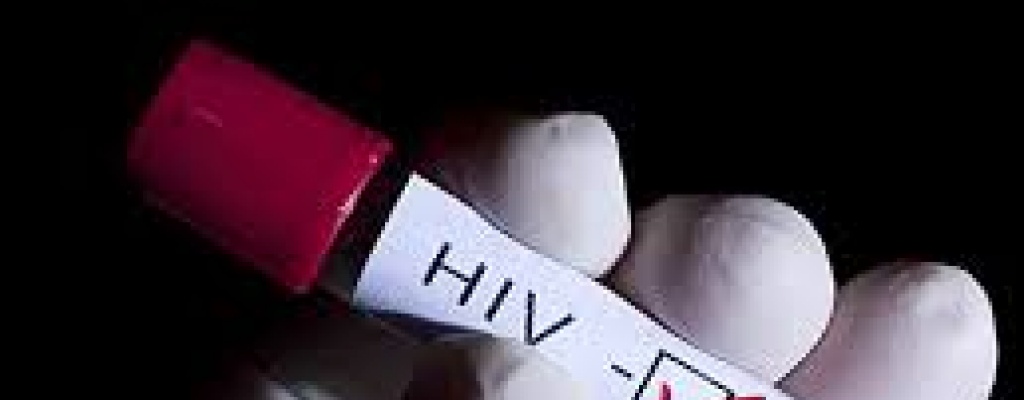 F�rmacos para el VIH se deben de tomar de inmediato tras el diagn�stico