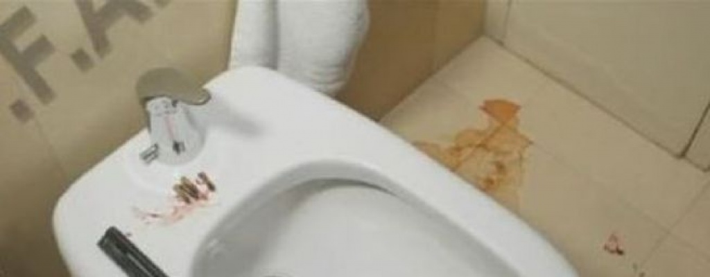 Concluy� el peritaje de la muerte del fiscal Nisman