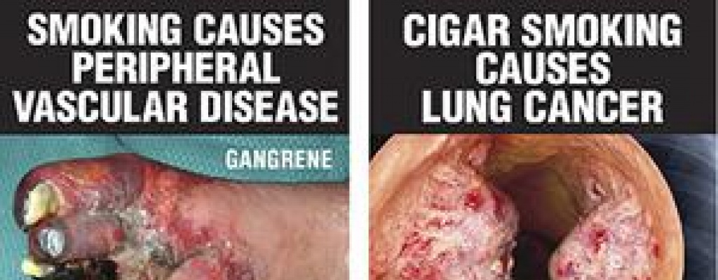 Envasado gen�rico del tabaco fracasa en el mundo, no reduce el consumo y vulnera derechos