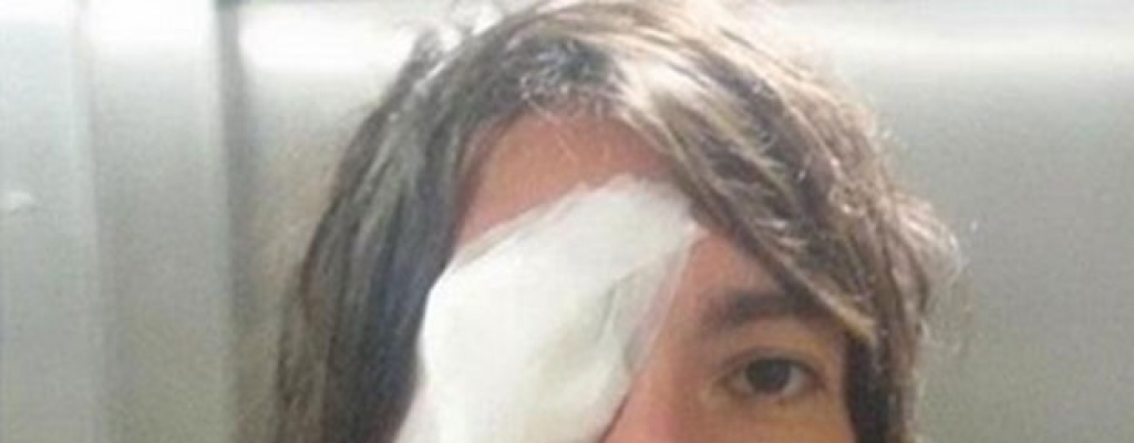 Futbolista argentino sufri� lesi�n en el ojo tras recibir una pedrada 