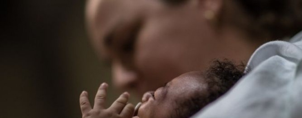 Aumentan casos de beb�s con microcefalia en Brasil en medio de epidemia de zika