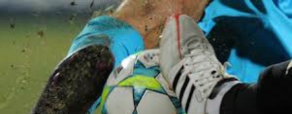 Nacional cay ante Plaza Colonia