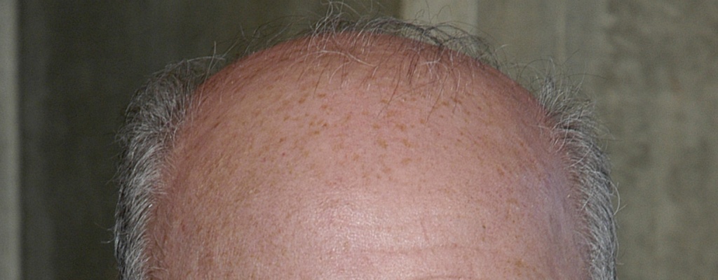 Falleci� �scar Magurno