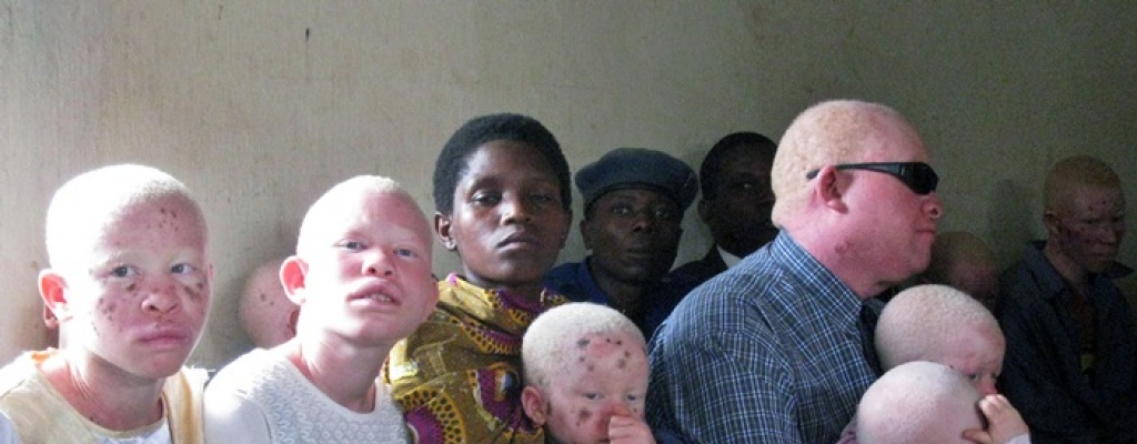 Quemaron vivas a siete personas acusadas de brujer�a en Tanzania