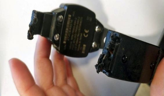 Investigan posible falla en tobillera electr�nica tras intento de femicidio