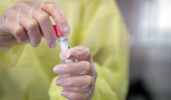 Detectan pacientes vacunados que contrajeron Covid, pero con s�ntomas leves