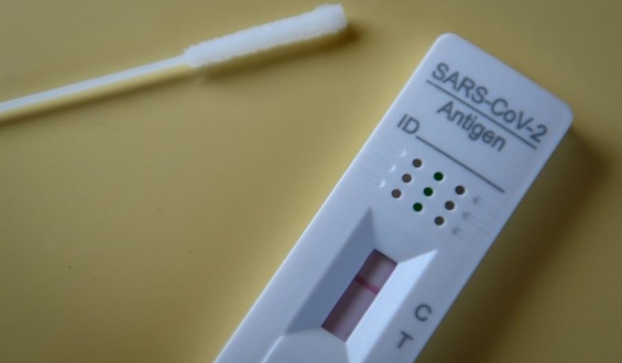 Los anticuerpos contra la covid duran al menos 8 meses en la mayor�a de casos