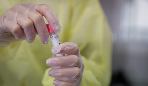 Covid-19: 45 fallecidos, 3.484 casos nuevos y 466 personas en CTI